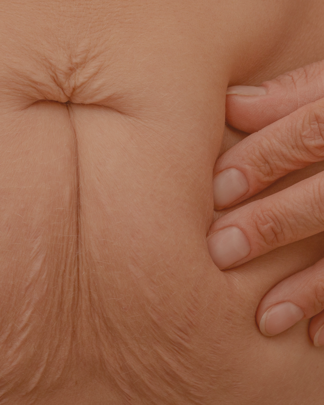 klinik estetik story 1080 x 1350 px 14