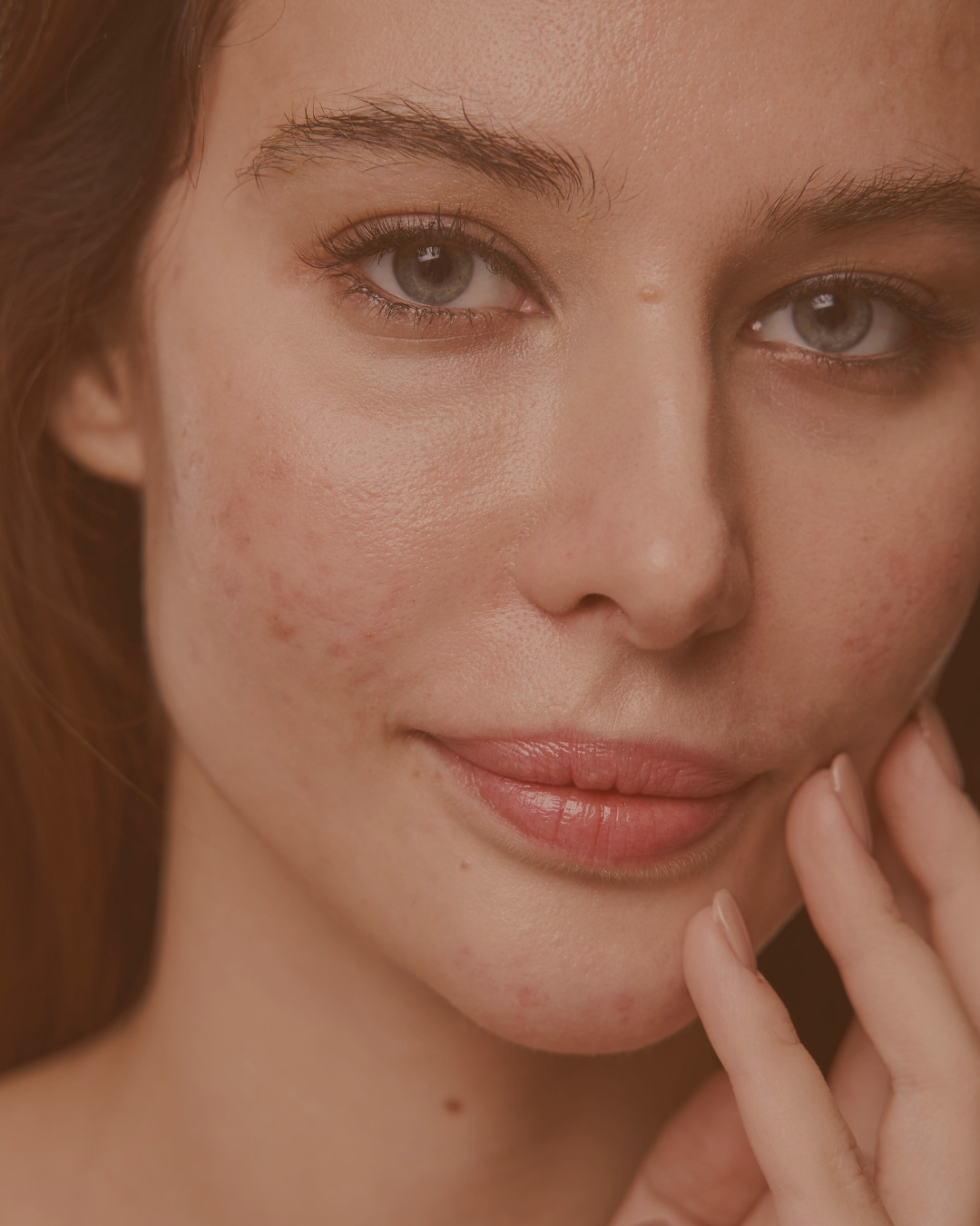 klinik estetik story 1080 x 1350 px 19