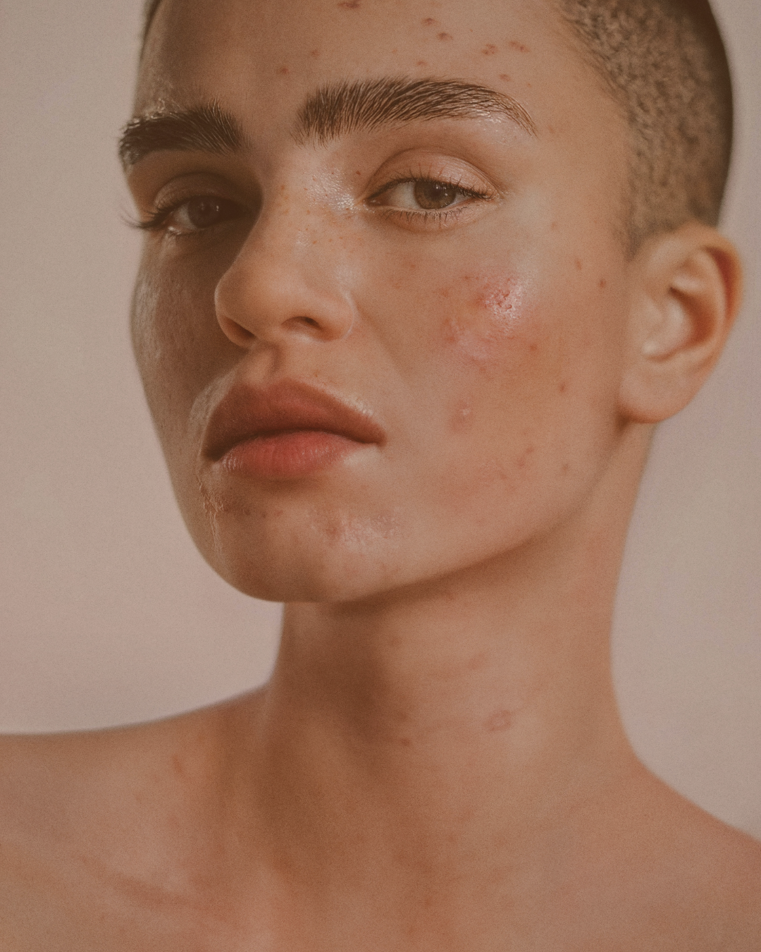 klinik estetik story 1080 x 1350 px 34