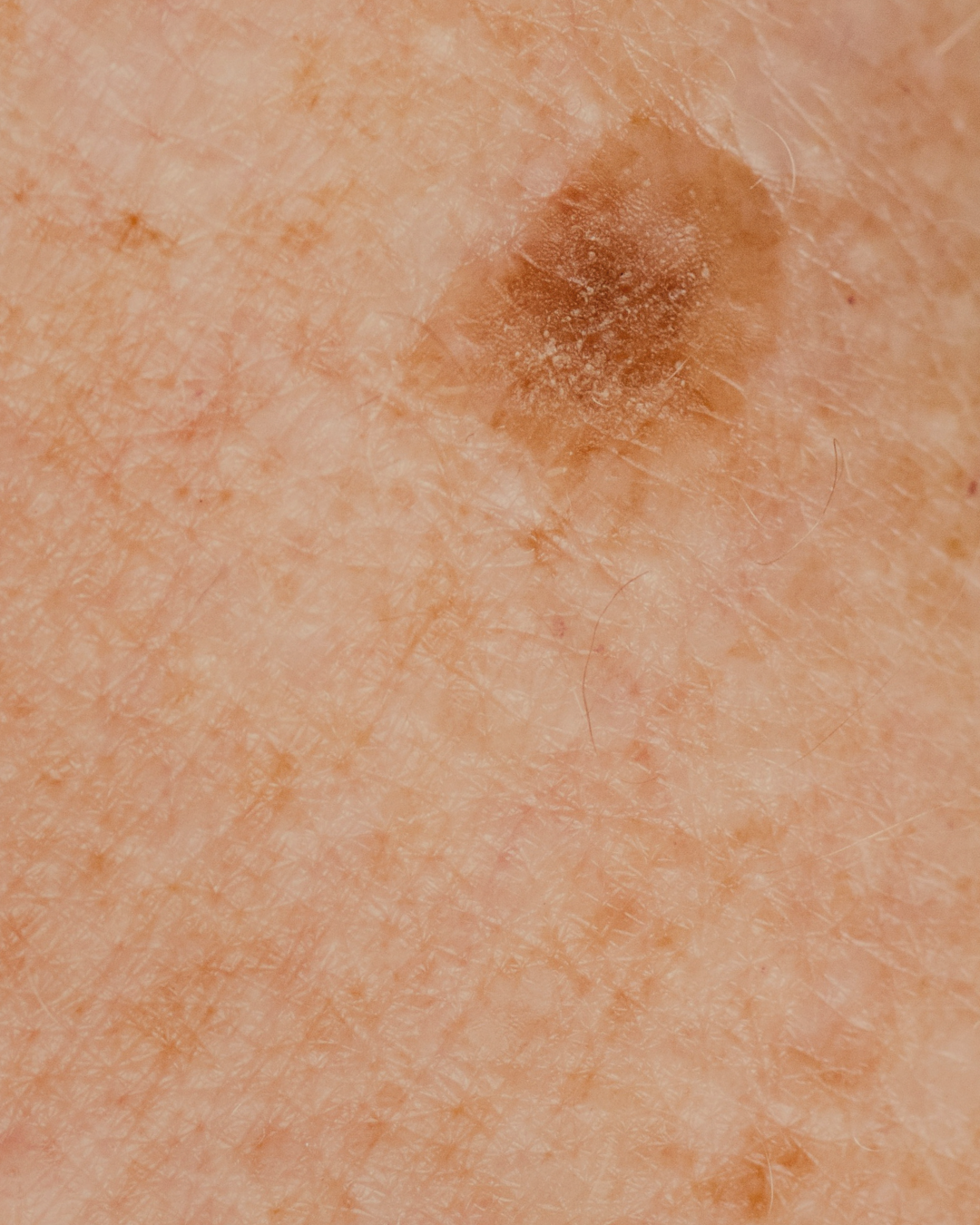 klinik estetik story 1080 x 1350 px 36