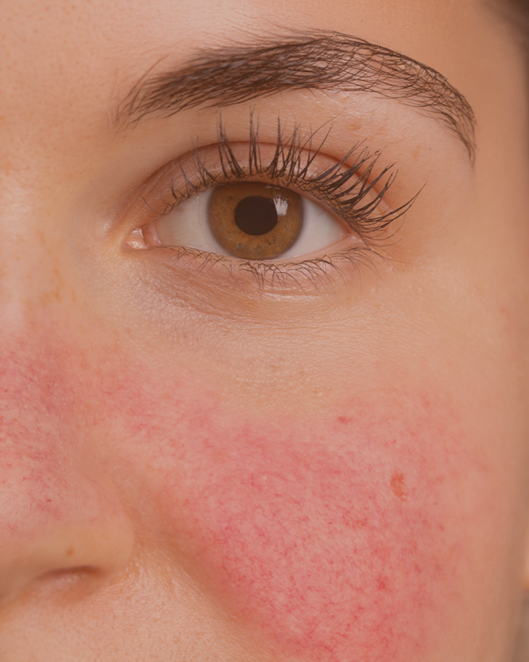 klinik estetik story 1080 x 1350 px 37