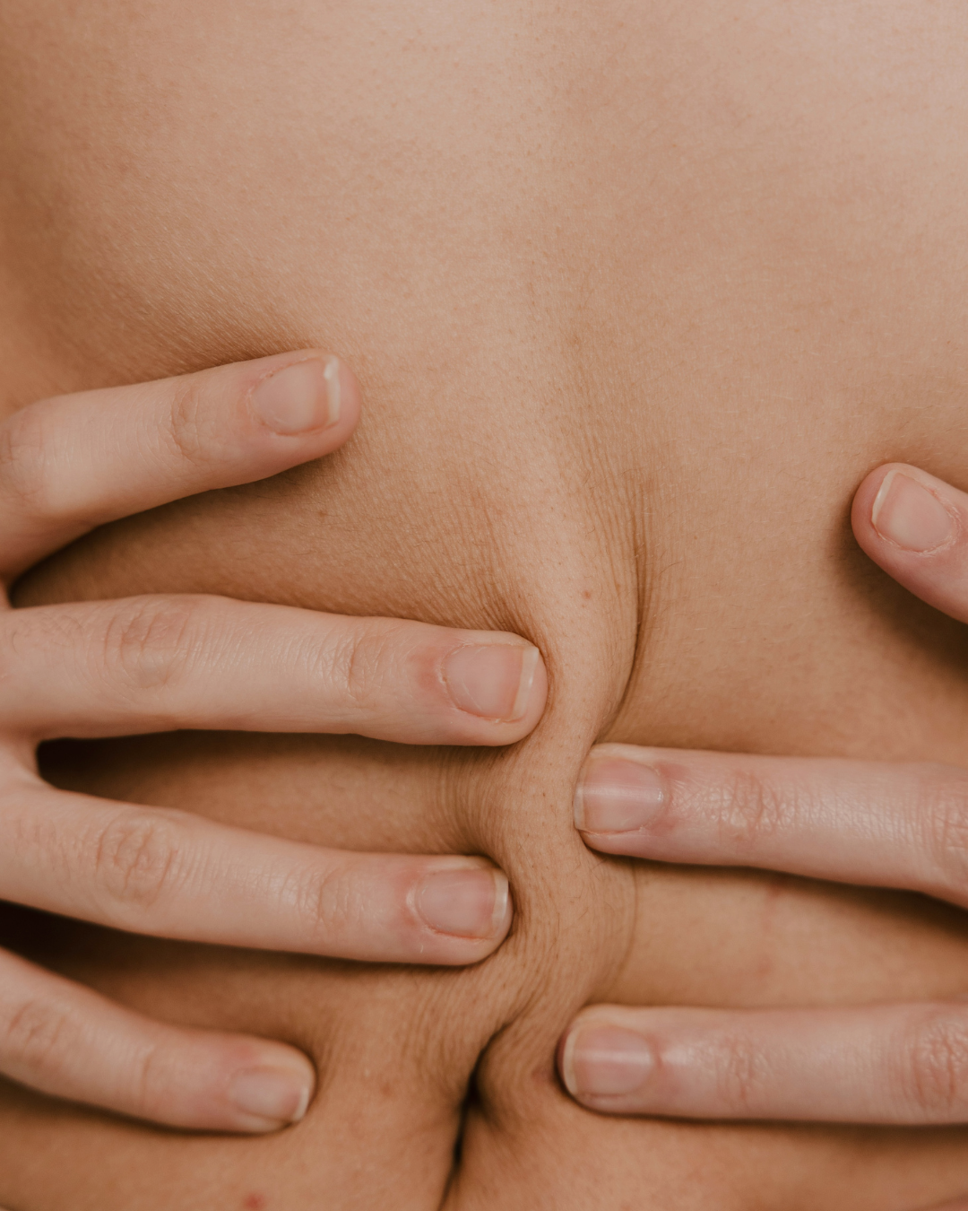 klinik estetik story 1080 x 1350 px 38