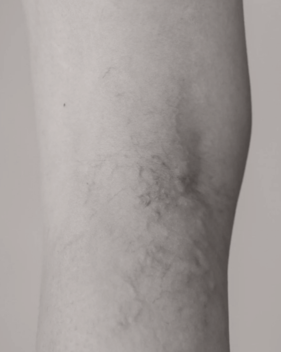 klinik estetik story 1080 x 1350 px 40