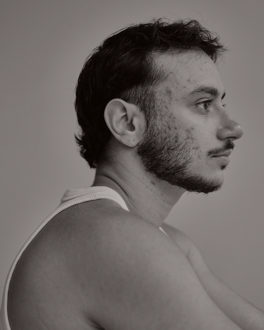 klinik estetik story 1080 x 1350 px 47 2