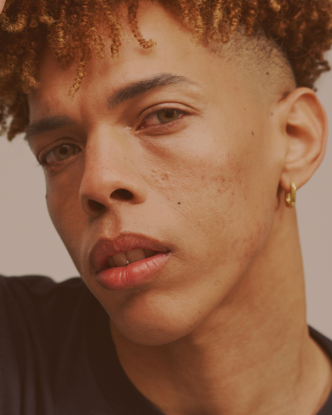 klinik estetik story 1080 x 1350 px 50 1