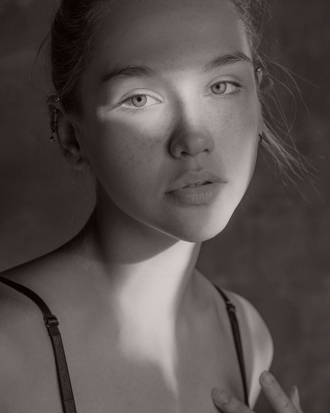 klinik estetik story 1080 x 1350 px 53