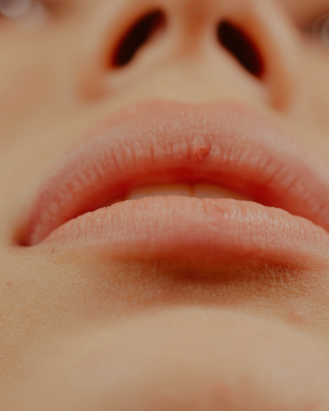 klinik estetik story 1080 x 1350 px 54 1