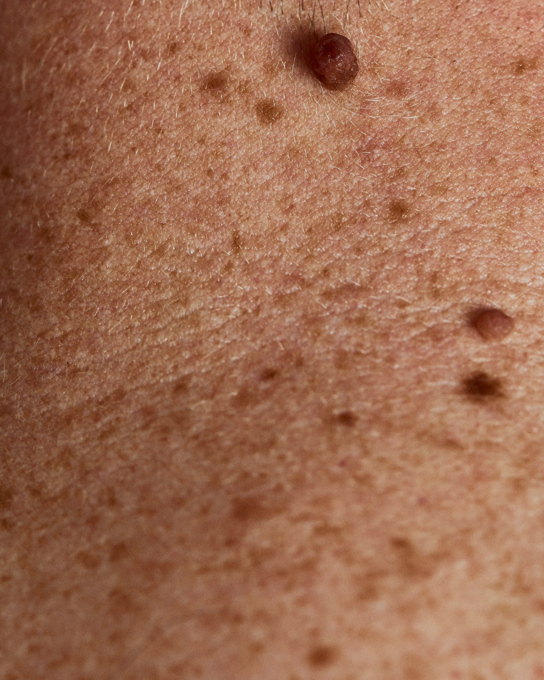 klinik estetik story 1080 x 1350 px 56 1