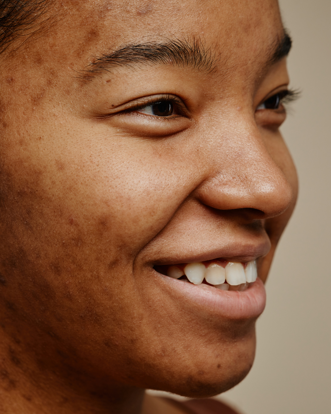 klinik estetik story 1080 x 1350 px 61 1