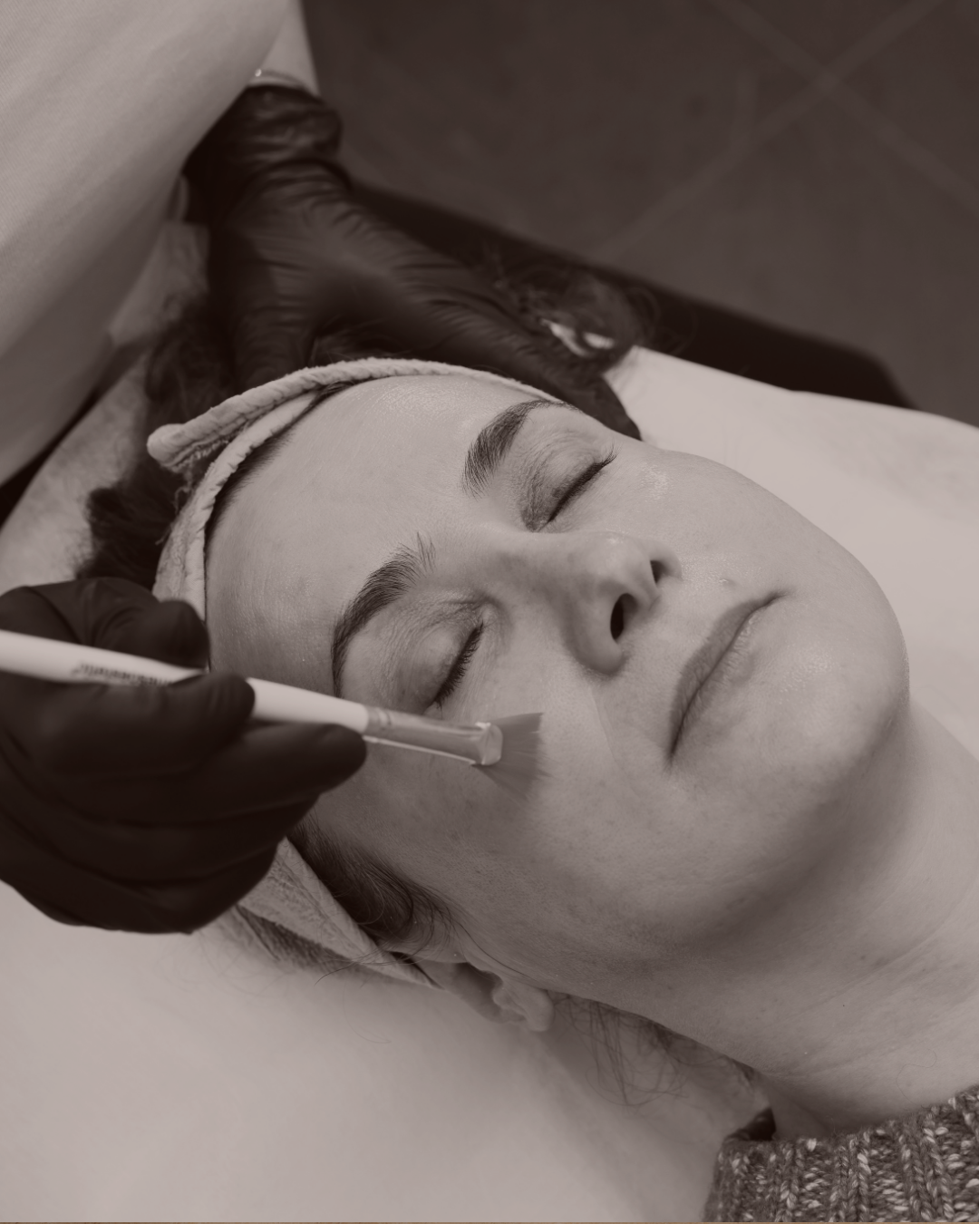 klinik estetik story 1080 x 1350 px 61