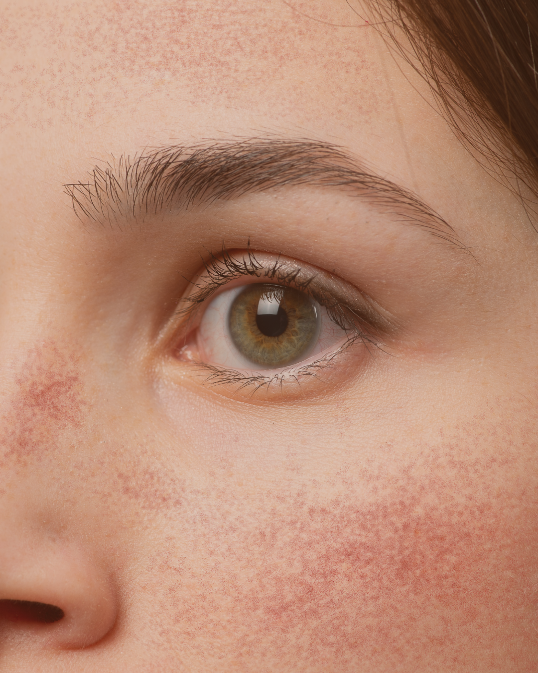 klinik estetik story 1080 x 1350 px 62