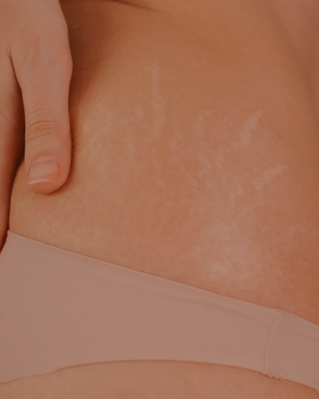 klinik estetik story 1080 x 1350 px 68