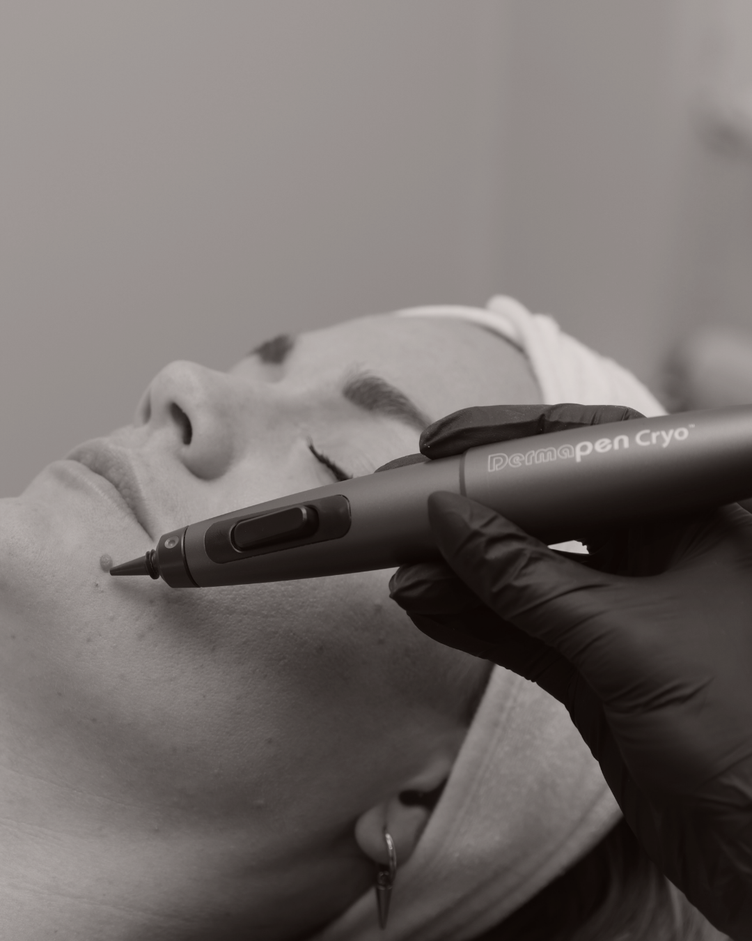 klinik estetik story 1080 x 1350 px 78 1