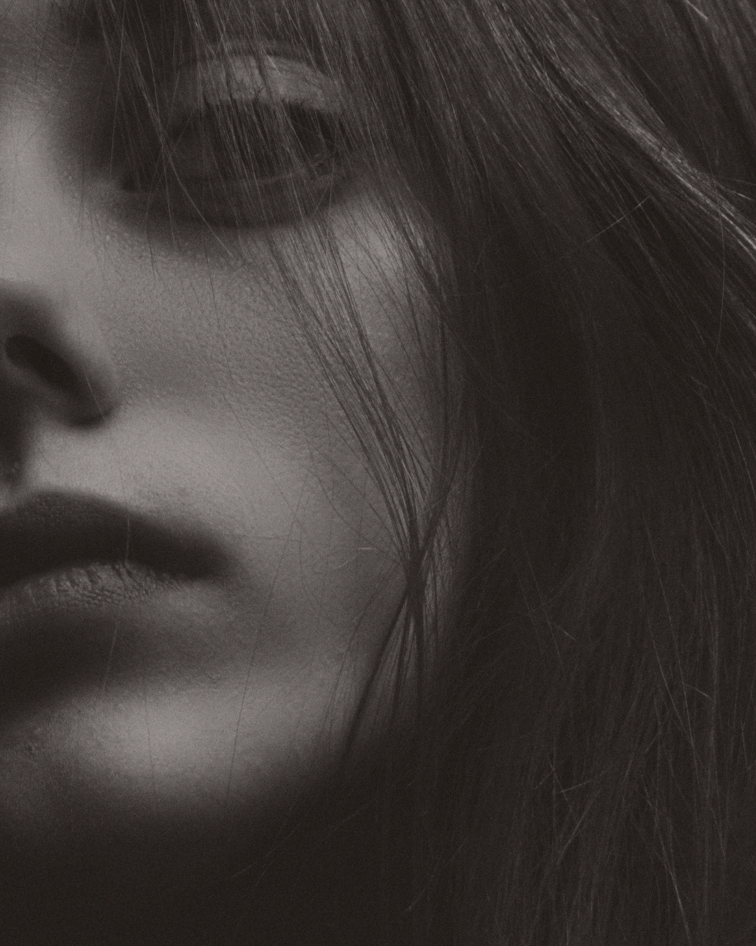 klinik estetik story 1080 x 1350 px 91 1