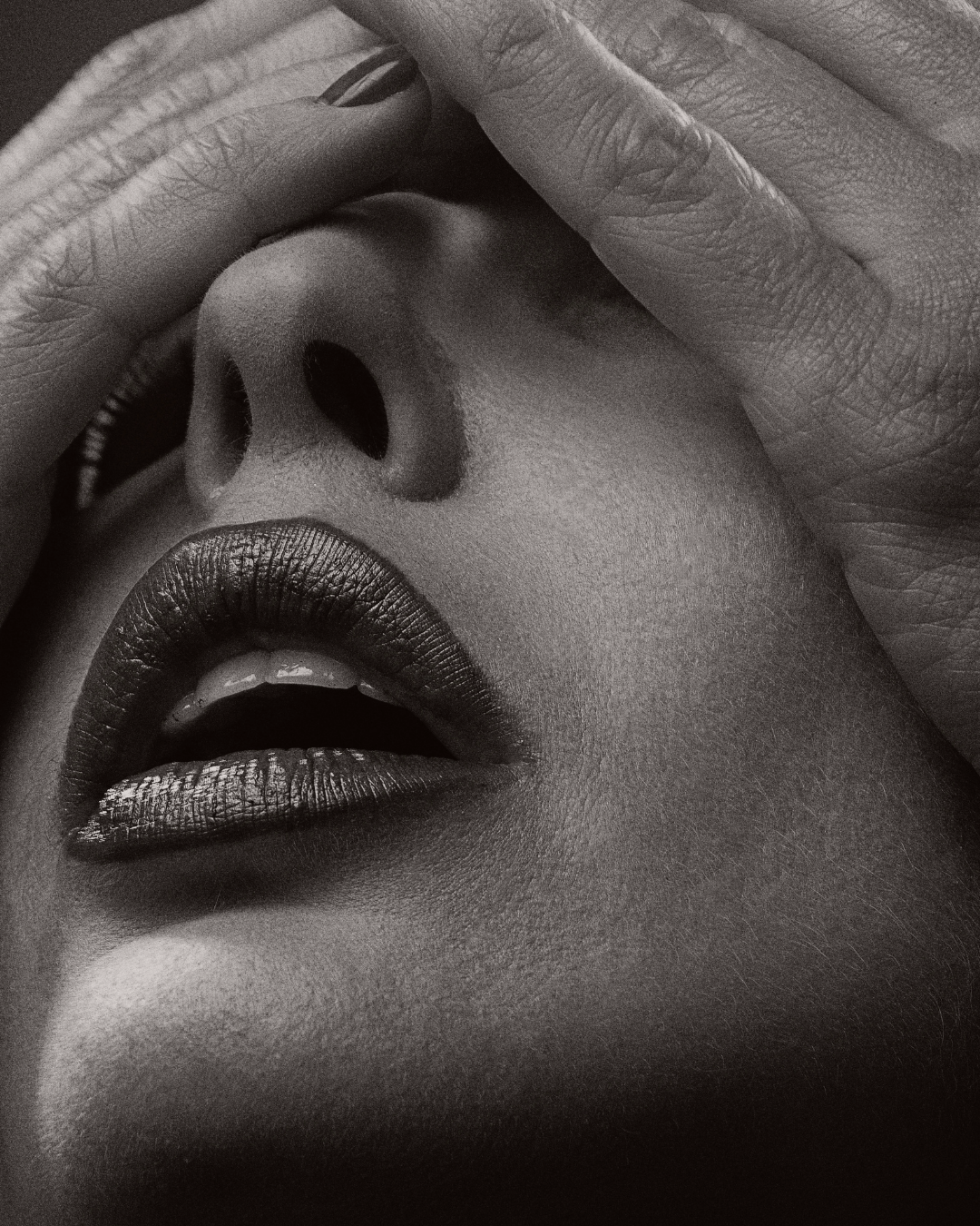 klinik estetik story 1080 x 1350 px 94 1