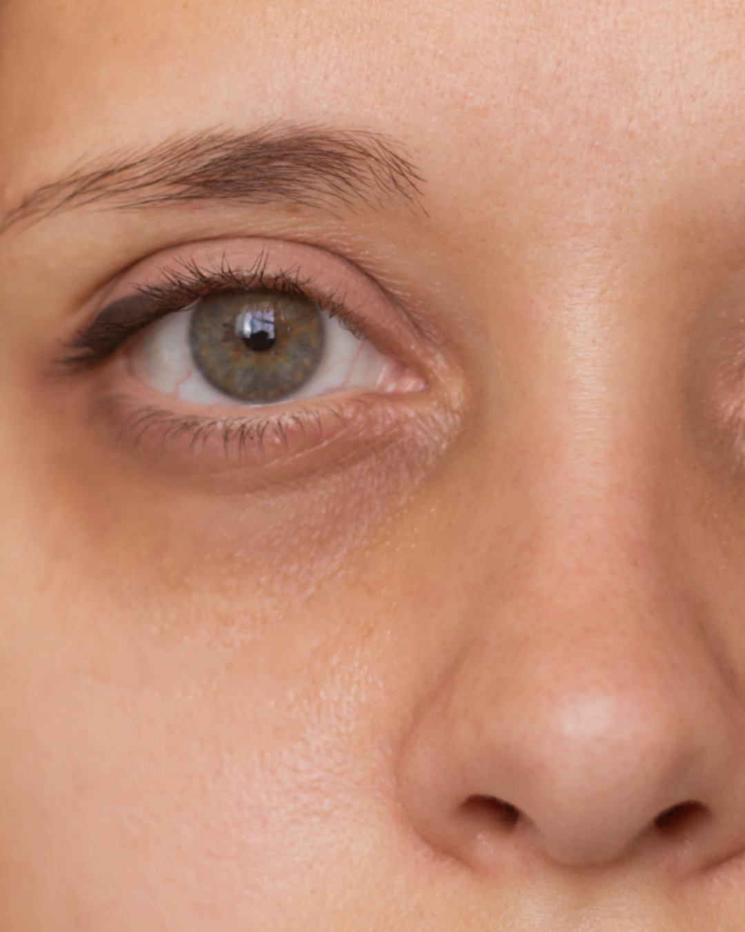 klinik estetik story 1080 x 1350 px 97