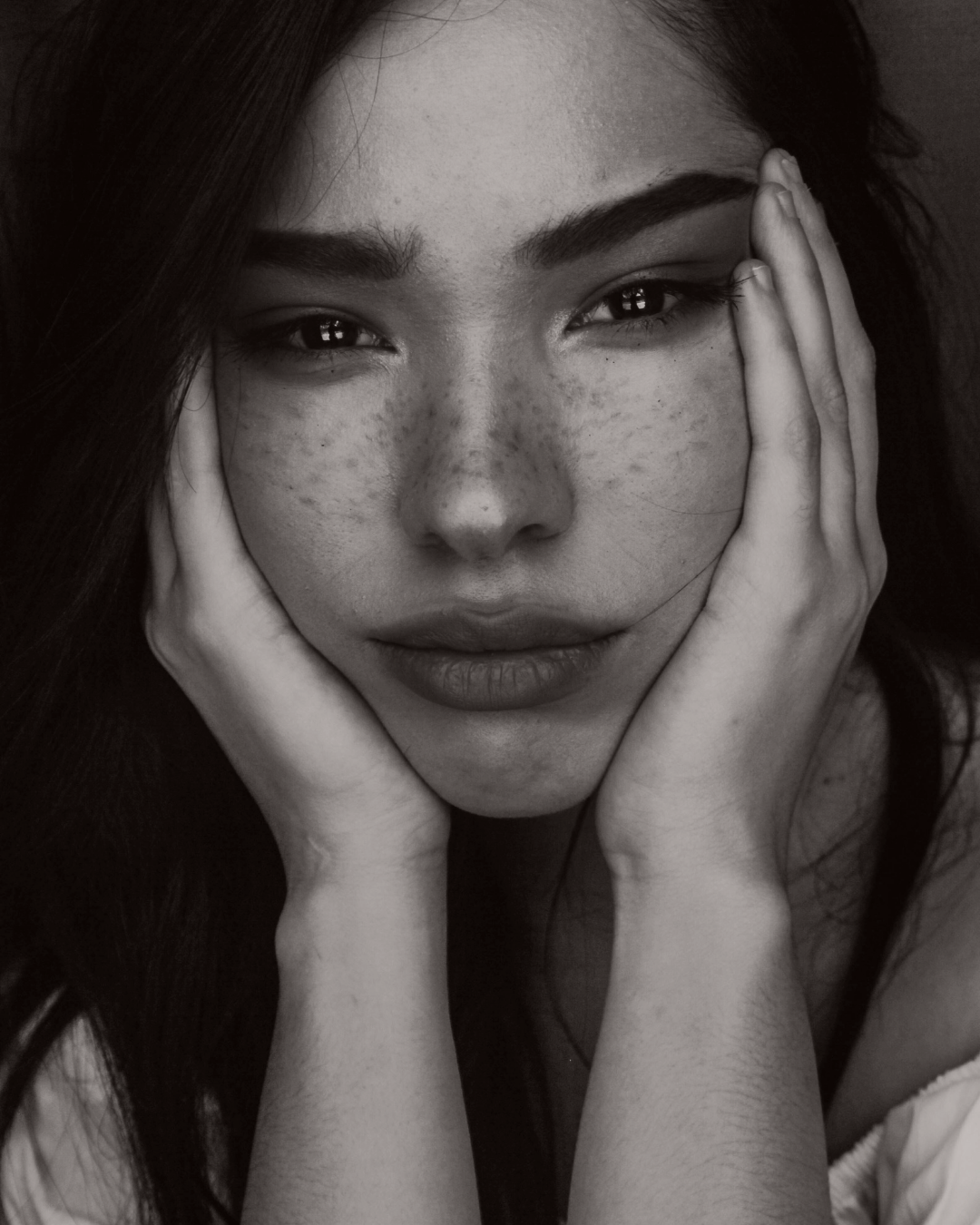 klinik estetik story 1080 x 1350 px 99 1